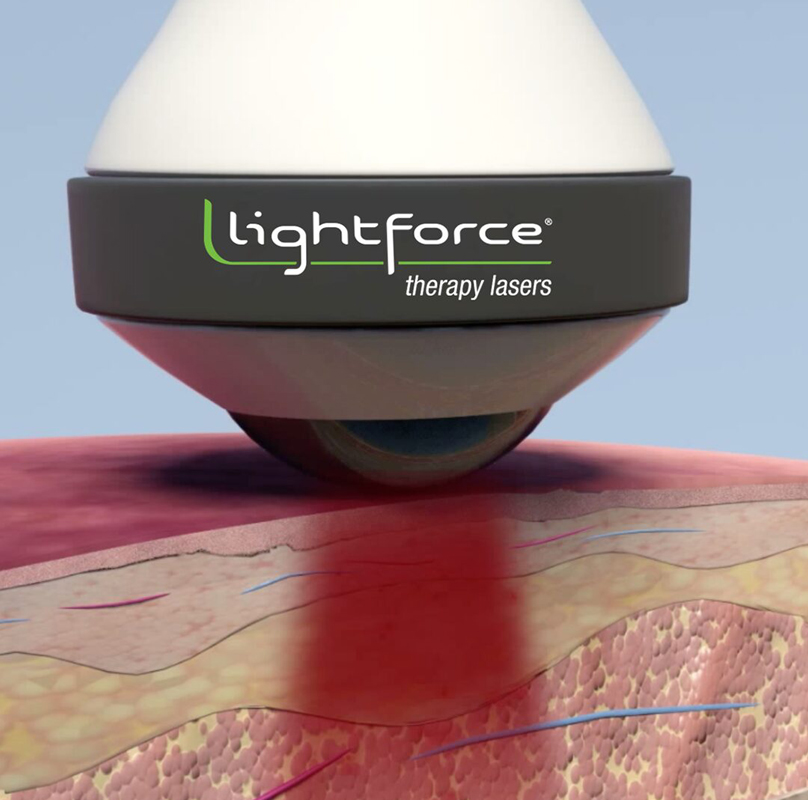 Lightforce class iv laser therapy penetration res img